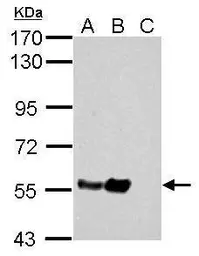 Anti-alpha Tubulin antibody used in Western Blot (WB). GTX112141